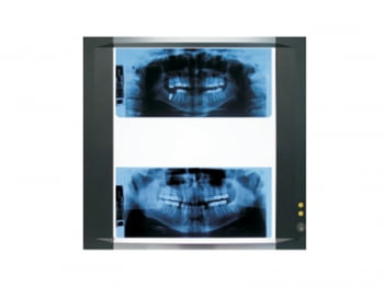 NEGATOSCOPIO VISOR DE PLASMA 1 CORPO DRILLER